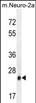 Rabbit Polyclonal Antibody to AP3S1 (N-term)