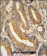 Rabbit Polyclonal Antibody to AP3S1 (N-term)