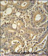 Rabbit Polyclonal Antibody to TPSD1