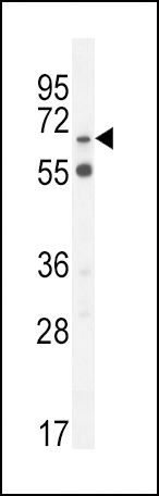 S6A12 (N-term)