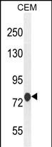 Rabbit Polyclonal Antibody to MCAF2