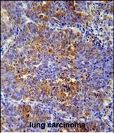Rabbit Polyclonal Antibody to MCAF2