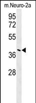 CASC4  (C-term)