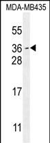 MYCT1  (C-term)
