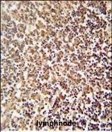 Rabbit Polyclonal Antibody to ZNF98  (C-term)