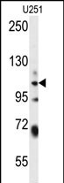 WWC3  (C-term)