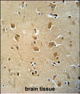 Rabbit Polyclonal Antibody to WWC3  (C-term)