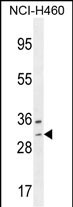WBSCR27 (N-term)