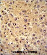 Rabbit Polyclonal Antibody to WBSCR27 (N-term)