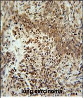 Rabbit Polyclonal Antibody to ZNF667