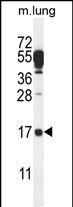 C14orf126