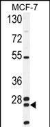 NUDT8 (N-term)