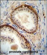 Rabbit Polyclonal Antibody to NUDT8 (N-term)