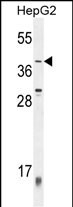 ZNF763