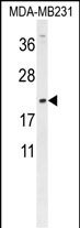 DMRTC1 (N-term)