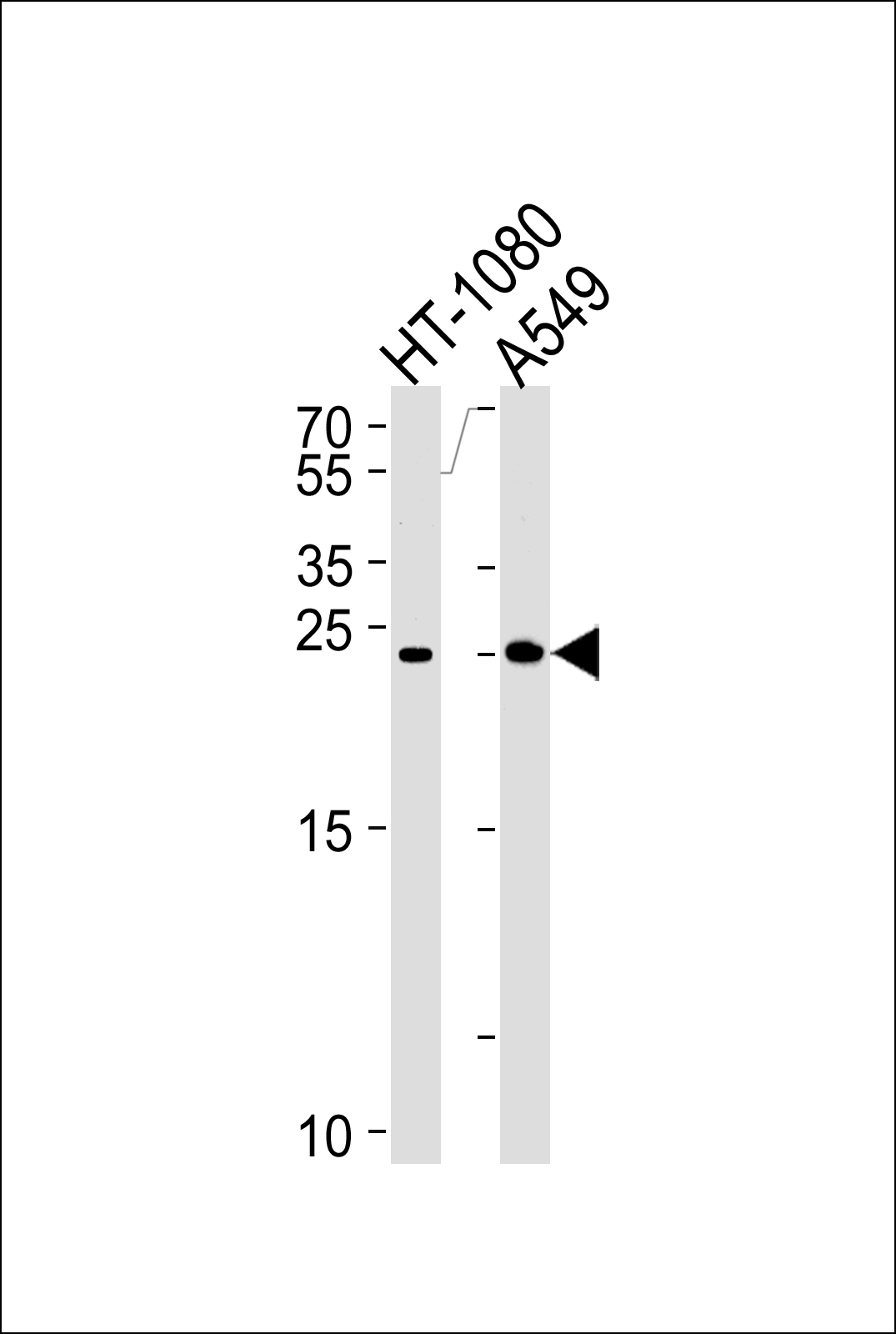 JOSD2 (N-term)