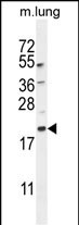 APG8a/b(MAP1LC3A/B)