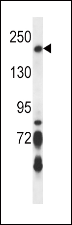BRIP1 (N-term)