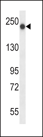 Rabbit Polyclonal Antibody to BRIP1 (N-term)