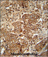 Rabbit Polyclonal Antibody to APCS
