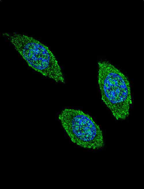 Rabbit Polyclonal Antibody to CSF2
