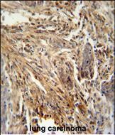 Rabbit Polyclonal Antibody to CSF2
