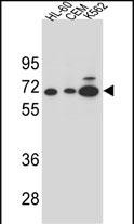 AMY2B (N-term)