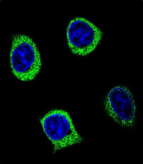 Rabbit Polyclonal Antibody to AMY2B (N-term)