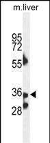 Rabbit Polyclonal Antibody to B3GNT4