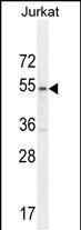 MPP1