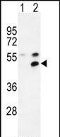 Rabbit Polyclonal Antibody to MPP1