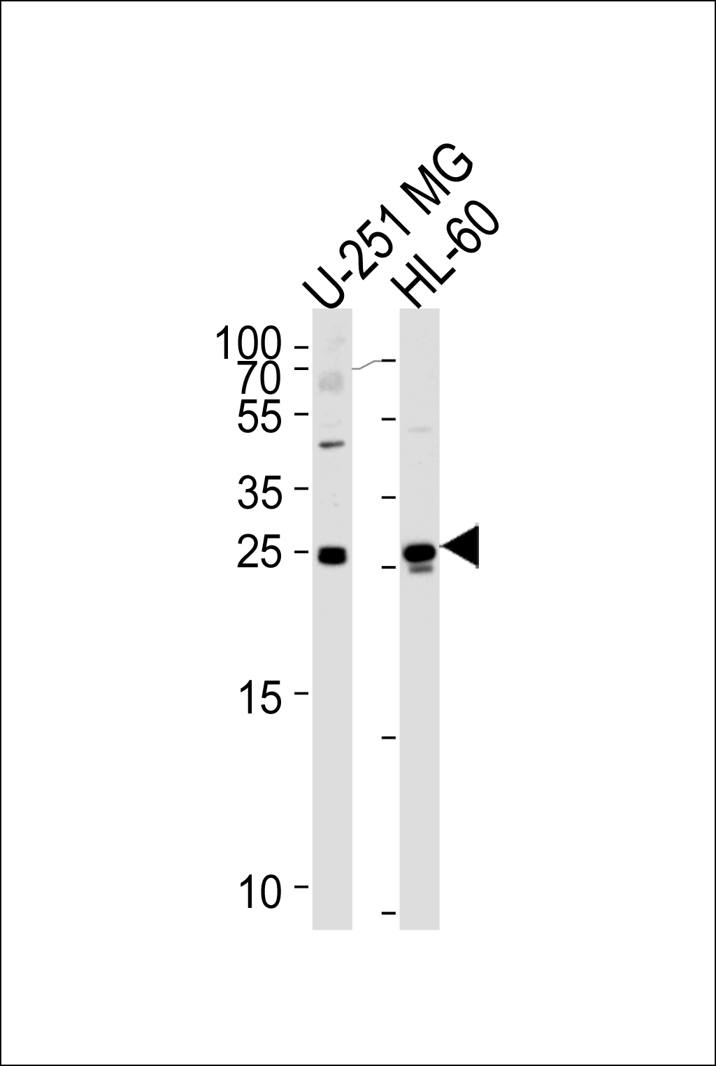 WIBG (N-term)