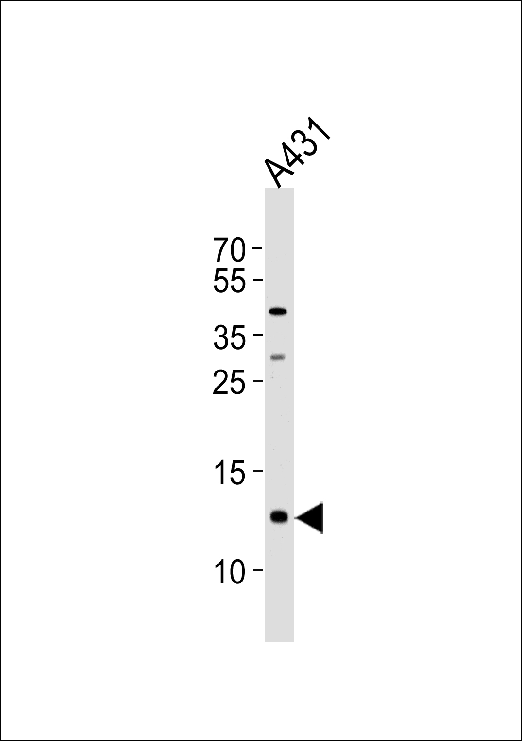 SPRR2A