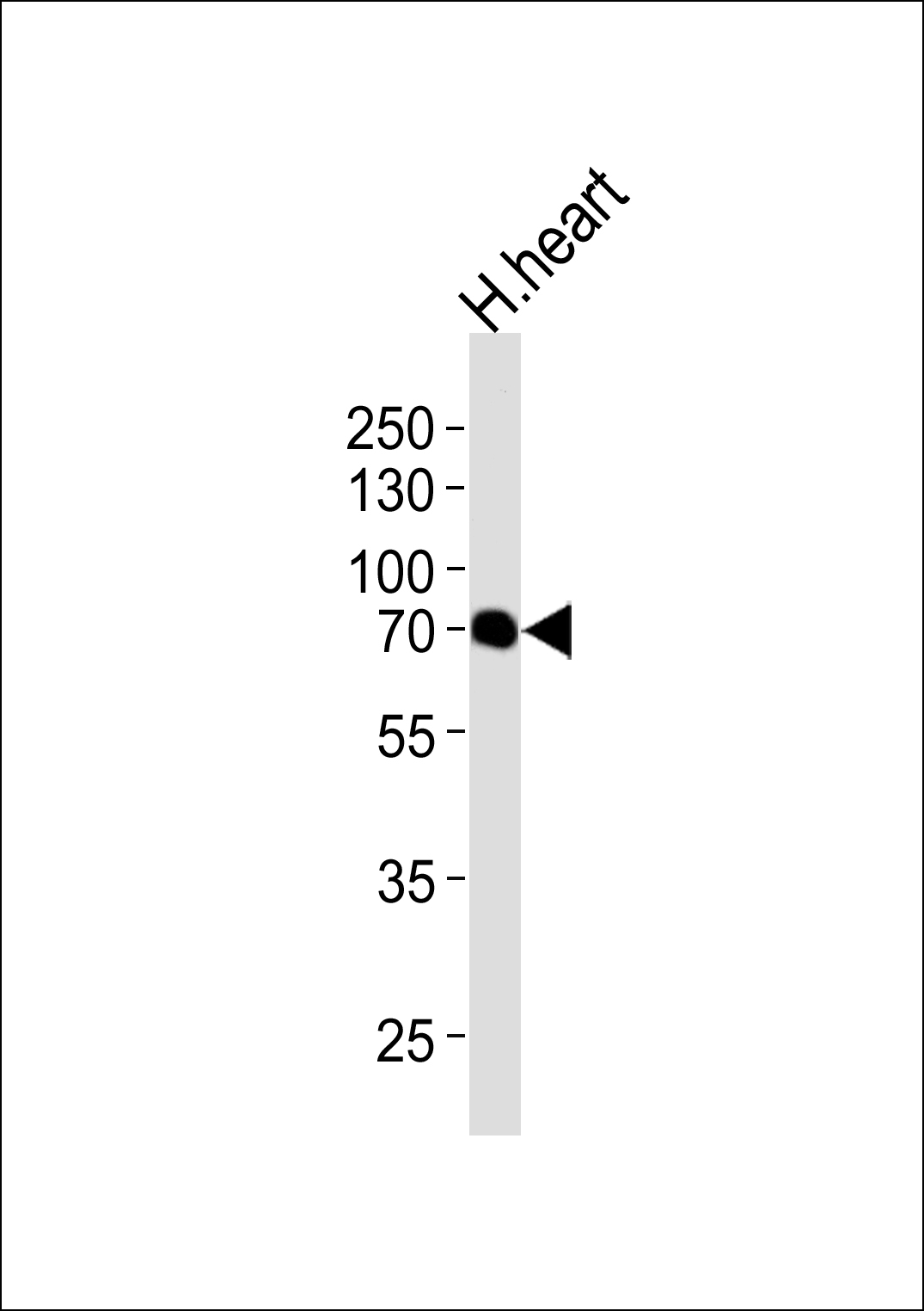 CLPX
