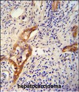 Rabbit Polyclonal Antibody to CLPX