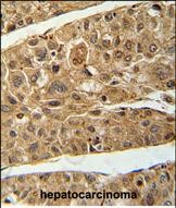 Rabbit Polyclonal Antibody to RT4I1  (C-term)