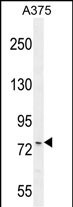 ANR44