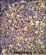 Rabbit Polyclonal Antibody to ANR44