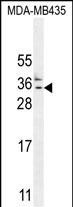 CK073  (N-term)