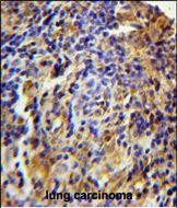 Rabbit Polyclonal Antibody to CK073  (N-term)