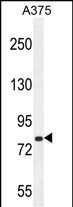 CB086  (C-term)