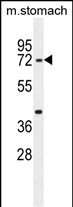 SRAC1  (C-term)