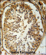 Rabbit Polyclonal Antibody to SRAC1  (C-term)