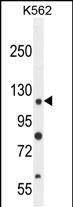 ANR52  (N-term)