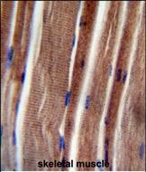 Rabbit Polyclonal Antibody to THUM3