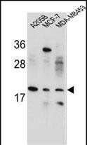VCX1  (N-term)