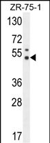 PUS3 (N-term)