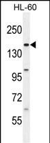 BCORL1 (N-term)