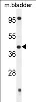 SLFNL1 (N-term)