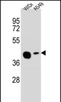 AMAC1L2 (N-term)